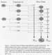 Chemical forms of Tritium responsible for exposures and doses