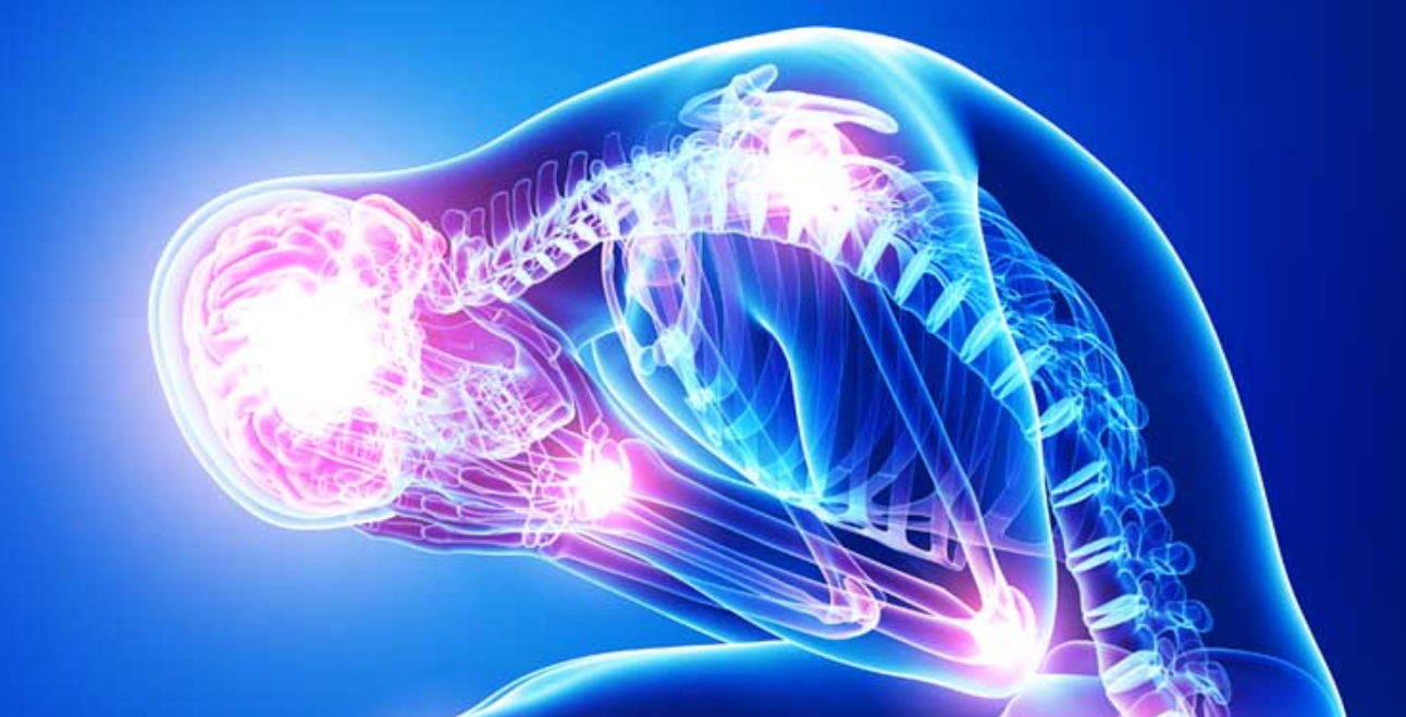 APA Stress Resource Skeleton bent over holding head in hands