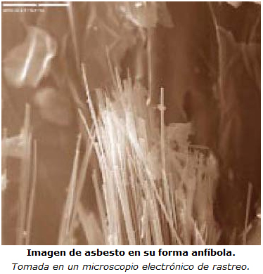 Imagen de microscopio de rastreo electr%26oacute;nico de asbesto en su forma anf%26iacute;bola