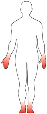 silueta de un cuerpo con las manos y los pies rojos