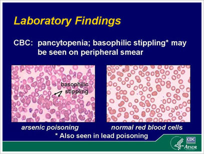 las conclusiones del laboratorio de envenenar de ars&eacute;nico y gl&oacute;bulos rojos normales