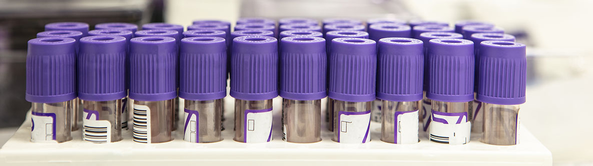 Close up view of test tubes with purple caps