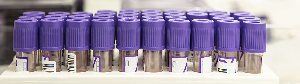 Pruebas de sangre para detectar PFAS Pruebas de sangre para detectar PFAS