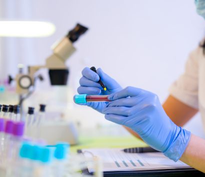 Mujer trabajando en un laboratorio, marcando un tubito con un rotulador