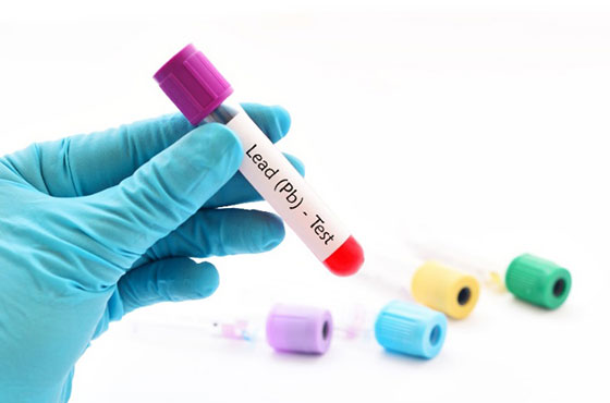 Biological Monitoring As Part of the EI